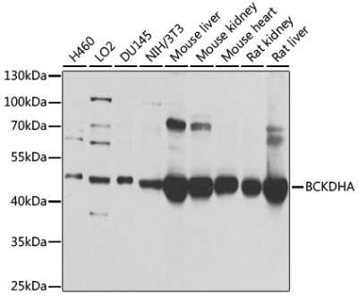 Western Blot: BCKDHA Antibody [NBP2-92584] - Analysis of extracts of various cell lines, using BCKDHA at 1:1000 dilution.Secondary antibody: HRP Goat Anti-Rabbit IgG (H+L) at 1:10000 dilution.Lysates/proteins: 25ug per lane.Blocking buffer: 3% nonfat dry milk in TBST.Detection: ECL Basic Kit .Exposure time: 1s.