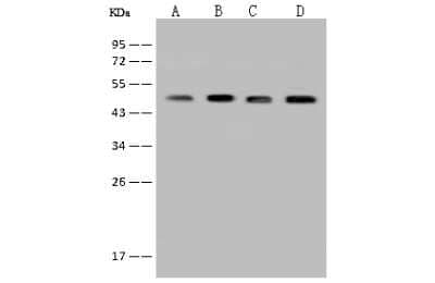 Western Blot: BCKDHA Antibody [NBP2-97503] - Anti-BCKDHA rabbit polyclonal antibody at 1:500 dilution. Lane A: MCF7 Whole Cell Lysate. Lane B: HepG2 Whole Cell Lysate. Lane C: HeLa Whole Cell Lysate. Lane D: Jurkat Whole Cell Lysate. Lysates/proteins at 30 ug per lane. Secondary Goat Anti-Rabbit IgG (H+L)/HRP at 1/10000 dilution. Developed using the ECL technique. Performed under reducing conditions. Predicted band size: 50 kDa. Observed band size: 50 kDa