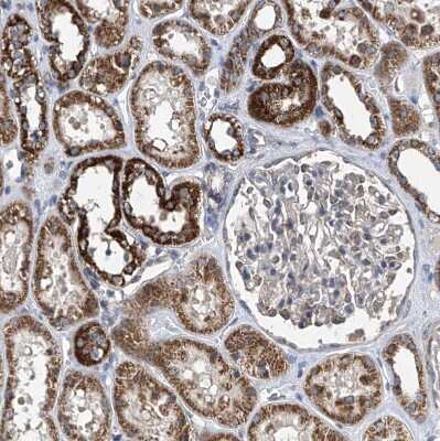 Immunohistochemistry-Paraffin BCKDHB Antibody