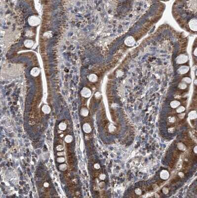 Immunohistochemistry-Paraffin BCKDHB Antibody