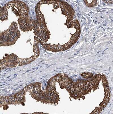 Immunohistochemistry-Paraffin BCKDHB Antibody - BSA Free