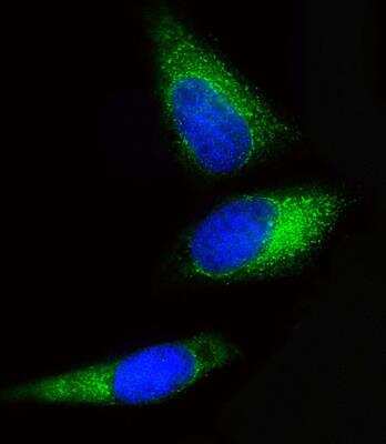 Immunocytochemistry/Immunofluorescence: BCKDHB Antibody (RB20925) [NBP2-29984] - Immunofluorescent analysis of 4% paraformaldehyde-fixed, 0. 1% Triton X-100 permeabilized Hela cells labeling BCKDHB with NBP2-29984, followed by Dylight(R) 488-conjugated goat anti-Rabbit IgG secondary antibody (green). Immunofluorescence image showing Cytoplasm staining on Hela cell line. The nuclear counter stain is DAPI (blue).