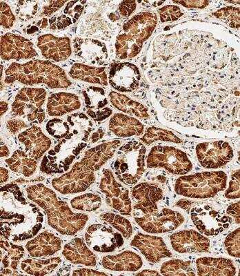 Immunohistochemistry-Paraffin: BCKDHB Antibody (RB20925) [NBP2-29984] - Immunohistochemical analysis of paraffin-embedded Human kidney tissue using NBP2-29984 performed on the Leica® BOND RXm. Tissue was fixed with formaldehyde at room temperature, antigen retrieval was by heat mediation with a EDTA buffer (pH9. 0). Samples were incubated with primary antibody for 1 hours at RT. A undiluted biotinylated CRF Anti-Polyvalent HRP Polymer antibody was used as the secondary antibody.