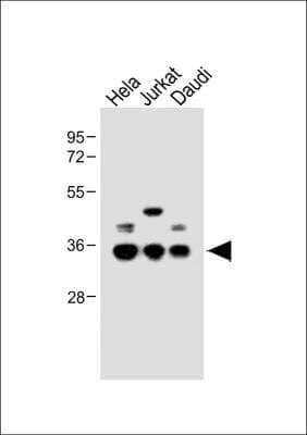 Western Blot: BCKDHB Antibody (RB20925) [NBP2-29984] - All lanes : Anti-BCKDHB Antibody (N-term). Lane 1: Hela whole cell lysate; Lane 2: Jurkat whole cell lysate; Lane 3: Daudi whole cell lysate. Lysates/proteins at 20 ug per lane. Secondary Goat Anti-Rabbit IgG, (H+L), Peroxidase conjugated. Predicted band size : 43 kDa. Blocking/Dilution buffer: 5% NFDM/TBST.