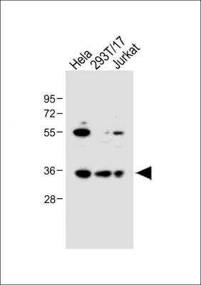 Western Blot: BCKDHB Antibody (RB20925) [NBP2-29984] - All lanes : Anti-BCKDHB Antibody (N-term). Lane 1: Hela whole cell lysate; Lane 2: 293T/17 whole cell lysate; Lane 3: Jurkat whole cell lysate. Lysates/proteins at 20 ug per lane. Secondary Goat Anti-Rabbit IgG, (H+L), Peroxidase conjugated. Predicted band size : 43 kDa. Blocking/Dilution buffer: 5% NFDM/TBST.