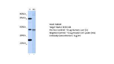 Western Blot: BCKDHB Antibody [NBP2-84500] - Host: Rabbit. Target: BCKDHB. Positive control (+): Human Liver (LI). Negative control (-): HepG2 Cell Lysate (HG). Antibody concentration: 1ug/ml