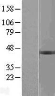 Western Blot BCKDHB Overexpression Lysate