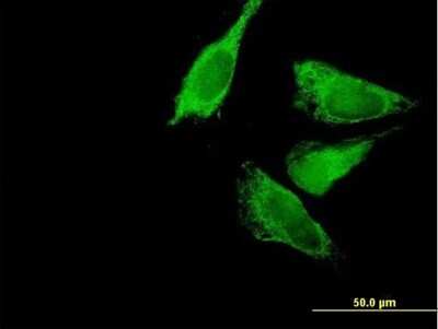 Immunocytochemistry/Immunofluorescence: BCKDK Antibody [H00010295-B01P] - Analysis of purified antibody to BCKDK on HeLa cell. (antibody concentration 10 ug/ml)