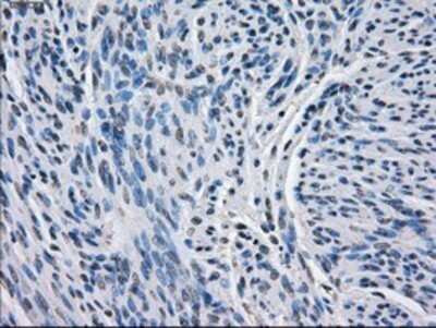 Immunohistochemistry: BCKDK Antibody (OTI11C9) - Azide and BSA Free [NBP2-71573] - Staining of paraffin-embedded Human endometrium tissue using anti-BCKDK mouse monoclonal antibody.