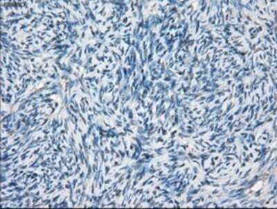 Immunohistochemistry: BCKDK Antibody (OTI11C9) - Azide and BSA Free [NBP2-71573] - Staining of paraffin-embedded Human Ovary tissue using anti-BCKDK mouse monoclonal antibody.