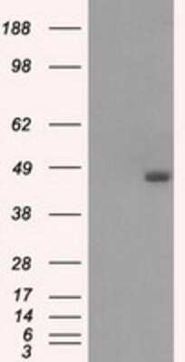 Western Blot: BCKDK Antibody (OTI11C9) - Azide and BSA Free [NBP2-71573] - HEK293T cells were transfected with the pCMV6-ENTRY control (Left lane) or pCMV6-ENTRY BCKDK (Right lane) cDNA for 48 hrs and lysed. Equivalent amounts of cell lysates (5 ug per lane) were separated by SDS-PAGE and immunoblotted with anti-BCKDK.