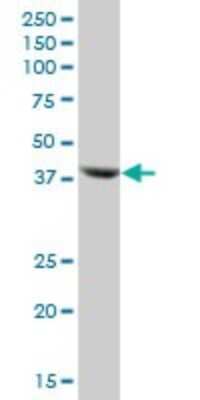 Western Blot: BCKDK Antibody [H00010295-B01P] - Analysis of BCKDK expression in human liver.
