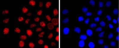 Immunocytochemistry/Immunofluorescence: BCL11B Antibody (JF09-90) [NBP2-67181] - Staining Ctip2 in LO2 cells (red). The nuclear counter stain is DAPI (blue). Cells were fixed in paraformaldehyde, permeabilised with 0.25% Triton X100/PBS.