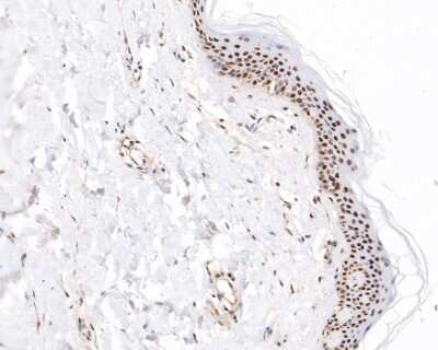 Immunohistochemistry-Paraffin: BCL11B Antibody (JF09-90) [NBP2-67181] - Analysis of paraffin-embedded human skin tissue using anti-BCL11B antibody. The section was pre-treated using heat mediated antigen retrieval with sodium citrate buffer (pH 6.0) for 20 minutes. The tissues were blocked in 5% BSA for 30 minutes at room temperature, washed with ddH2O and PBS, and then probed with the primary antibody (1/200) for 30 minutes at room temperature. The detection was performed using an HRP conjugated compact polymer system. DAB was used as the chromogen. Tissues were counterstained with hematoxylin and mounted with DPX.