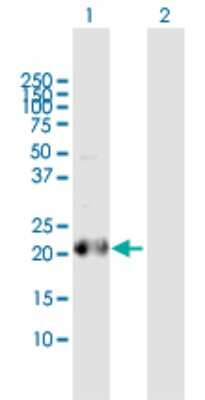 Western Blot: BCL2L10 Antibody [H00010017-D01P] - Analysis of BCL2L10 expression in transfected 293T cell line by BCL2L10 polyclonal antibody.Lane 1: BCL2L10 transfected lysate(23.20 KDa).Lane 2: Non-transfected lysate.