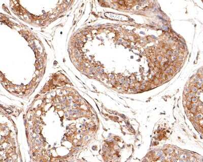 Immunohistochemistry-Paraffin: BCL2L12 Antibody (JE51-66) [NBP2-80451] - Analysis of paraffin-embedded human testis tissue using anti-BCL2L12 antibody. The section was pre-treated using heat mediated antigen retrieval with sodium citrate buffer (pH 6.0) for 20 minutes. The tissues were blocked in 1% BSA for 30 minutes at room temperature, washed with ddH2O and PBS, and then probed with the primary antibody (1/400) for 30 minutes at room temperature. The detection was performed using an HRP conjugated compact polymer system. DAB was used as the chromogen. Tissues were counterstained with hematoxylin and mounted with DPX.
