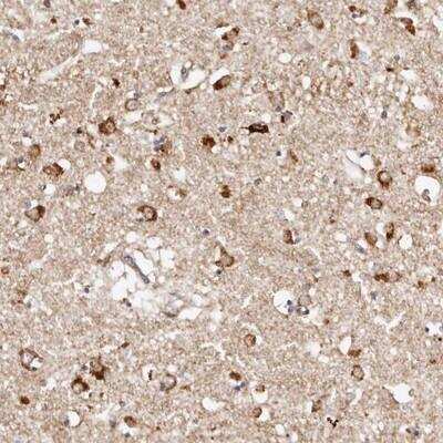 Immunohistochemistry: BCL2L15 Antibody [NBP1-90768] - Staining of human lateral ventricle shows strong cytoplasmic positivity in neuronal cells.