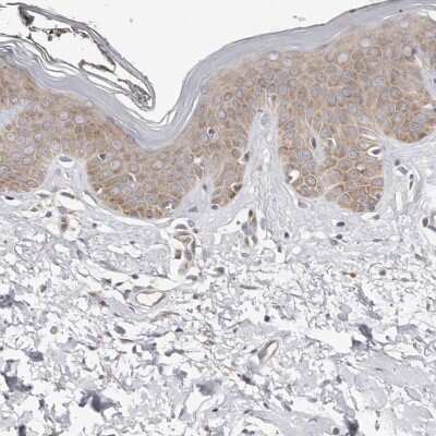 Immunohistochemistry-Paraffin: BCL2L15 Antibody [NBP1-90767] - Staining of human skin shows low expression as expected.