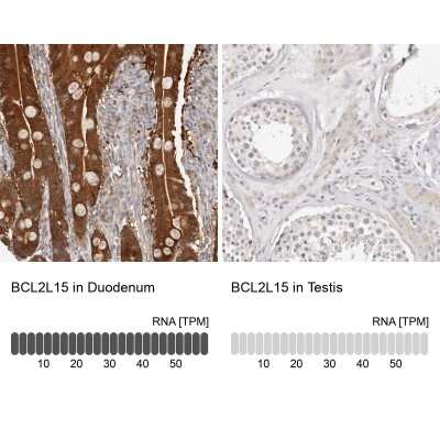 <b>Orthogonal Strategies Validation. </b>Immunohistochemistry-Paraffin: BCL2L15 Antibody [NBP1-90767] - Analysis in human duodenum and testis tissues. Corresponding BCL2L15 RNA-seq data are presented for the same tissues.