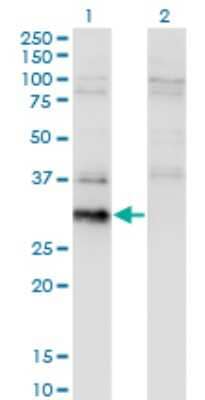 Western Blot: BCL7B Antibody (4G1) [H00009275-M02] - Analysis of BCL7B expression in transfected 293T cell line by BCL7B monoclonal antibody (M02), clone 4G1.Lane 1: BCL7B transfected lysate(22.2 KDa).Lane 2: Non-transfected lysate.