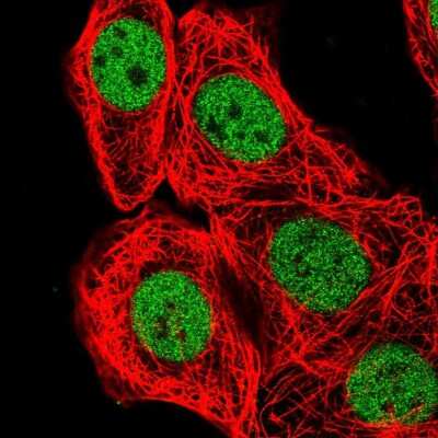 Immunocytochemistry/Immunofluorescence: BCL7B Antibody [NBP2-55835] - Staining of human cell line MCF7 shows localization to nucleoplasm.