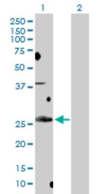 Western Blot: BCL7B Antibody [H00009275-D01P] - Analysis of BCL7B expression in transfected 293T cell line by BCL7B polyclonal antibody.Lane 1: BCL7B transfected lysate(22.20 KDa).Lane 2: Non-transfected lysate.