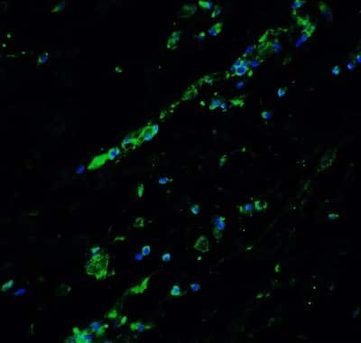 Immunocytochemistry/Immunofluorescence: BCL9-2 Antibody [NBP1-76542] - Staining of Bcl9L in human breast tissue with Bcl9L antibody at 20 ug/ml.