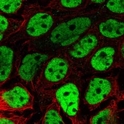 <b>Orthogonal Strategies Validation. </b>Immunocytochemistry/Immunofluorescence: BCL9-2 Antibody [NBP2-14350] - Staining of human cell line CACO-2 shows localization to nucleoplasm. Antibody staining is shown in green.