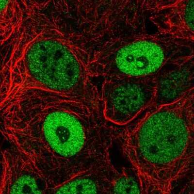 Immunocytochemistry/Immunofluorescence: BCL9-2 Antibody [NBP2-55060] - Staining of human cell line MCF7 shows localization to nucleoplasm & nucleoli.