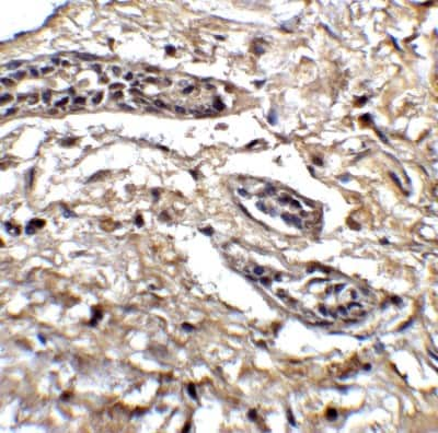 Immunohistochemistry: BCL9-2 Antibody [NBP1-76542] - Staining of Bcl9L in human breast tissue with Bcl9L antibody at 5 ug/ml.