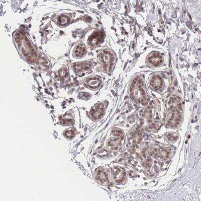 Immunohistochemistry-Paraffin: BCL9-2 Antibody [NBP2-14350] - Staining of human breast shows moderate to strong nuclear positivity in glandular cells.