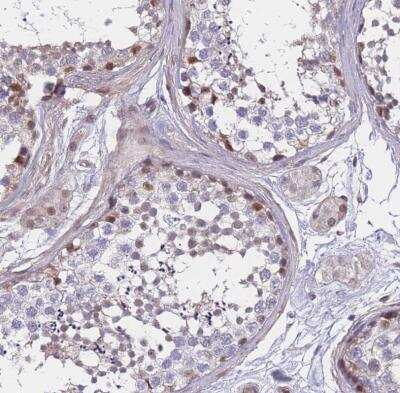 Immunohistochemistry-Paraffin: BCL9-2 Antibody [NBP2-14350] - Staining of human testis shows moderate nuclear positivity in cells in seminiferous ducts.