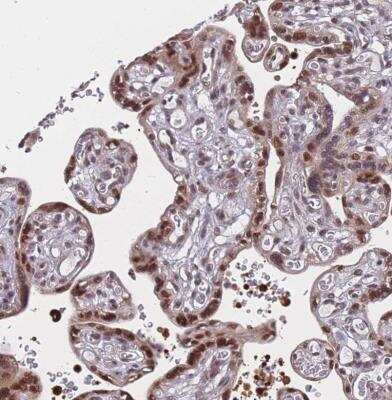 Immunohistochemistry-Paraffin: BCL9-2 Antibody [NBP2-14350] - Staining of human placenta shows moderate to strong nuclear positivity in trophoblastic cells.