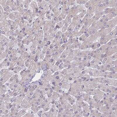 Immunohistochemistry-Paraffin: BCL9-2 Antibody [NBP2-14350] - Staining of human liver shows no positivity in hepatocytes as expected.