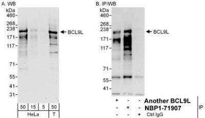 Western Blot: BCL9-2 Antibody [NBP1-71907] - Whole cell lysate from HeLa (15 and 50 mcg for WB; 1 mg for IP, 20% of IP loaded) and 293T (T; 50 mcg) cells.  Affinity purified rabbit anti-BCL9L antibody  used for WB at 0.1 mcg/ml (A) and 1 mcg/ml (B) and used for IP at 6 mcg/mg lysate.  BCL9L was also immunoprecipitated by another rabbit anti-BCL9L antibody, which recognizes an upstream epitope.