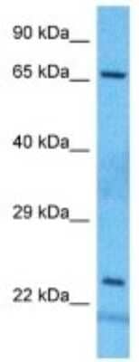 Western Blot: BCMO1 Antibody [NBP3-10784] - Western blot analysis of BCMO1 in 721_B Whole Cell lysates. Antibody dilution at 1.0ug/ml