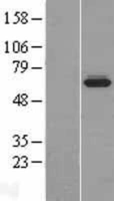 Western Blot: BCMO1 Overexpression Lysate (Adult Normal) [NBP2-06984] Left-Empty vector transfected control cell lysate (HEK293 cell lysate); Right -Over-expression Lysate for BCMO1.