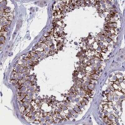 Immunohistochemistry-Paraffin: BCNP Antibody [NBP1-90771] - Staining of human testis shows strong cytoplasmic and membranous positivity in cells in seminiferus ducts.