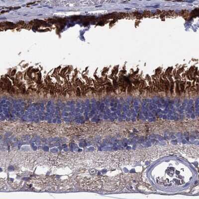 Immunohistochemistry-Paraffin BCO2 Antibody