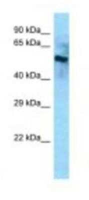 Western Blot: BCO2 Antibody [NBP1-98381] - Mouse Kidney Lysate 1.0ug/ml, Gel Concentration: 12%