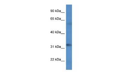 Western Blot: BCO2 Antibody [NBP2-84501] - WB Suggested Anti-BCO2 Antibody. Titration: 1.0 ug/ml. Positive Control: HT1080 Whole Cell
