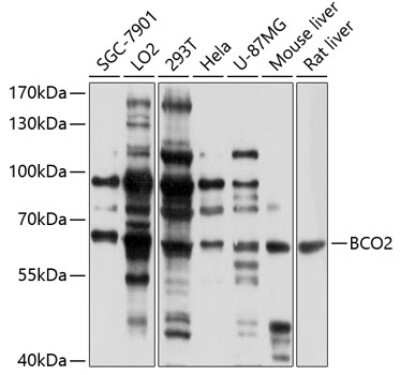 Western Blot: BCO2 Antibody [NBP2-92452] - Analysis of extracts of various cell lines, using BCO2 at 1:1000 dilution.Secondary antibody: HRP Goat Anti-Rabbit IgG (H+L) at 1:10000 dilution.Lysates/proteins: 25ug per lane.Blocking buffer: 3% nonfat dry milk in TBST.Detection: ECL Basic Kit .Exposure time: 30s.