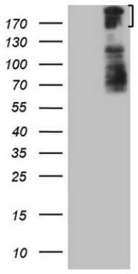 Western Blot: BCOR Antibody (4F6) [NBP2-46571] - Analysis of HEK293T cells were transfected with the pCMV6-ENTRY control (Left lane) or pCMV6-ENTRY BCOR.