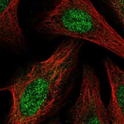 Immunocytochemistry/Immunofluorescence: BCOR Antibody [NBP2-58057] - Staining of human cell line U-2 OS shows localization to nucleus.