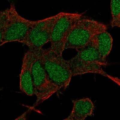 Immunocytochemistry/Immunofluorescence: BCOR Antibody [NBP2-68956] - Staining of human cell line SH-SY5Y shows localization to nucleus.