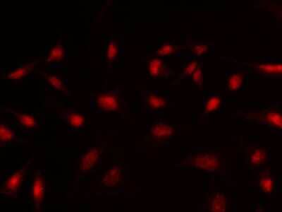 Immunocytochemistry/Immunofluorescence: BCOR Antibody [NBP2-98770] - Immunofluorescence staining of BCOR in HeLa cells. Cells were fixed with 4% PFA, permeabilzed with 0.3% Triton X-100 in PBS, blocked with 10% serum, and incubated with rabbit anti-human BCOR polyclonal antibody (1:1000) at 4C overnight. Then cells were stained with the Alexa Fluor(R)594-conjugated Goat Anti-rabbit IgG secondary antibody (red). Positive staining was localized to nucleus.