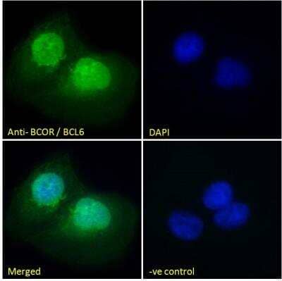 Immunofluorescence: BCOR Antibody [NB100-1280] - Analysis of paraformaldehyde fixed U2OS cells, permeabilized with 0.15% Triton. Primary incubation 1hr (10 ug/mL) followed by Alexa Fluor 488 secondary antibody (2 ug/mL), showing nuclear staining. The nuclear stain is DAPI (blue). Negative control: Unimmunized goat IgG (10 ug/mL) followed by Alexa Fluor 488 secondary antibody (2 ug/mL).