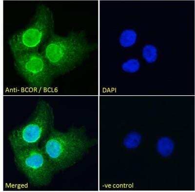 Immunofluorescence: BCOR Antibody [NB100-1280] - Analysis of paraformaldehyde fixed A431 cells, permeabilized with 0.15% Triton. Primary incubation 1hr (10 ug/mL) followed by Alexa Fluor 488 secondary antibody (2 ug/mL), showing nuclear and weak cytoplasmic staining. The nuclear stain is DAPI (blue). Negative control: Unimmunized goat IgG (10 ug/mL) followed by Alexa Fluor 488 secondary antibody (2 ug/mL).