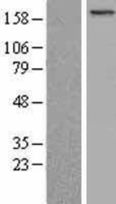 Western Blot: BCOR Overexpression Lysate (Adult Normal) [NBL1-07956] Left-Empty vector transfected control cell lysate (HEK293 cell lysate); Right -Over-expression Lysate for BCOR.