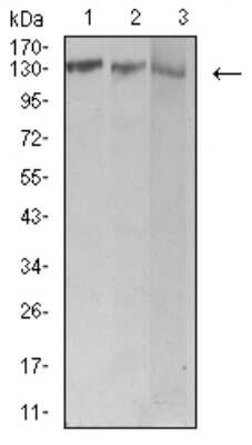 Western Blot: BCR Antibody (1E11G12) [NBP2-61707] - Analysis using BCR mouse mAb against Jurkat (1), Hela (2), and Ramos (3) cell lysate.